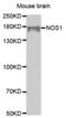 Nitric Oxide Synthase 1 antibody, abx001261, Abbexa, Western Blot image 