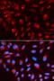 C-Terminal Binding Protein 1 antibody, orb135330, Biorbyt, Immunocytochemistry image 