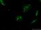 YTH N6-Methyladenosine RNA Binding Protein 3 antibody, 25537-1-AP, Proteintech Group, Immunofluorescence image 