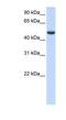 Spermatogenesis Associated 17 antibody, NBP1-55371, Novus Biologicals, Western Blot image 
