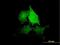 Tensin 4 antibody, H00084951-B01P, Novus Biologicals, Immunofluorescence image 