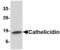 Cathelicidin Antimicrobial Peptide antibody, TA306515, Origene, Western Blot image 