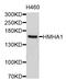Rho GTPase Activating Protein 45 antibody, STJ112483, St John