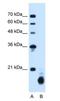 Peptidylprolyl Isomerase B antibody, NBP1-62356, Novus Biologicals, Western Blot image 