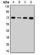 DnaJ homolog subfamily C member 2 antibody, LS-C667895, Lifespan Biosciences, Western Blot image 