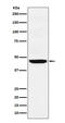 SEC61 Translocon Alpha 2 Subunit antibody, M17281, Boster Biological Technology, Western Blot image 