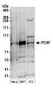 Lysine Acetyltransferase 2B antibody, A301-666A, Bethyl Labs, Western Blot image 