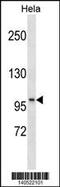 Protein phosphatase Slingshot homolog 1 antibody, MBS9205789, MyBioSource, Western Blot image 