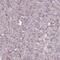 Neuronal Differentiation 4 antibody, NBP2-13932, Novus Biologicals, Immunohistochemistry paraffin image 