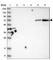 Hexosaminidase D antibody, HPA022834, Atlas Antibodies, Western Blot image 