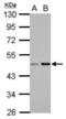 Coiled-Coil And C2 Domain Containing 2B antibody, PA5-31820, Invitrogen Antibodies, Western Blot image 