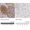 Bruton Tyrosine Kinase antibody, NBP1-89206, Novus Biologicals, Immunohistochemistry paraffin image 