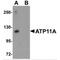 ATPase Phospholipid Transporting 11A antibody, MBS151310, MyBioSource, Western Blot image 