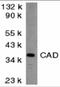 DNA fragmentation factor subunit beta antibody, 2007, ProSci Inc, Western Blot image 