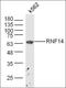 ADAM Metallopeptidase Domain 2 antibody, orb317551, Biorbyt, Western Blot image 