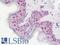 DDX39A antibody, LS-B10825, Lifespan Biosciences, Immunohistochemistry paraffin image 