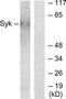 Spleen Associated Tyrosine Kinase antibody, TA326257, Origene, Western Blot image 
