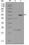 EPH Receptor A5 antibody, NBP1-47387, Novus Biologicals, Western Blot image 