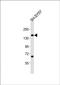 Keratin 76 antibody, orb389099, Biorbyt, Western Blot image 