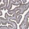 Cyclin Dependent Kinase 20 antibody, NBP1-91215, Novus Biologicals, Immunohistochemistry frozen image 