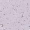 Decorin antibody, HPA064736, Atlas Antibodies, Immunohistochemistry frozen image 