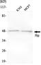 Hsc70-interacting protein antibody, STJ98498, St John