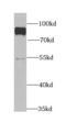 Poly(A)-Specific Ribonuclease antibody, FNab06150, FineTest, Western Blot image 