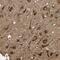 Leucine Rich Repeat And Coiled-Coil Centrosomal Protein 1 antibody, PA5-53006, Invitrogen Antibodies, Immunohistochemistry frozen image 