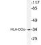 Major Histocompatibility Complex, Class II, DO Alpha antibody, LS-C177380, Lifespan Biosciences, Western Blot image 