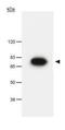 PES1 antibody, GTX23626, GeneTex, Western Blot image 