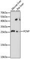 PEST Proteolytic Signal Containing Nuclear Protein antibody, A15482, ABclonal Technology, Western Blot image 
