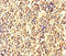Ankyrin Repeat And Death Domain Containing 1A antibody, A64982-100, Epigentek, Immunohistochemistry paraffin image 