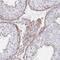 F-Box And Leucine Rich Repeat Protein 13 antibody, PA5-63417, Invitrogen Antibodies, Immunohistochemistry frozen image 