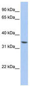 Zinc Finger Protein 584 antibody, TA341517, Origene, Western Blot image 
