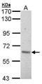 A-Raf Proto-Oncogene, Serine/Threonine Kinase antibody, TA308536, Origene, Western Blot image 