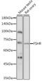Follicle Stimulating Hormone Receptor antibody, GTX64391, GeneTex, Western Blot image 