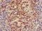 Insulin receptor substrate 2 antibody, LS-C682206, Lifespan Biosciences, Immunohistochemistry paraffin image 