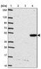 Coiled-coil domain-containing protein 62 antibody, NBP2-32398, Novus Biologicals, Western Blot image 