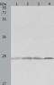 Prx-III antibody, TA322470, Origene, Western Blot image 