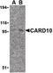 Caspase Recruitment Domain Family Member 10 antibody, LS-B470, Lifespan Biosciences, Western Blot image 