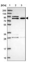 Calcium-activated chloride channel regulator 2 antibody, NBP2-33482, Novus Biologicals, Western Blot image 