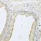 Progressive ankylosis protein homolog antibody, GTX64821, GeneTex, Immunohistochemistry paraffin image 