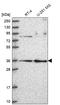 Ribonuclease P/MRP Subunit P38 antibody, HPA050398, Atlas Antibodies, Western Blot image 