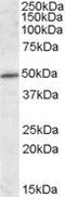 IFT57 antibody, PA5-19110, Invitrogen Antibodies, Western Blot image 