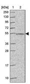 Abhydrolase Domain Containing 18 antibody, PA5-62150, Invitrogen Antibodies, Western Blot image 