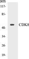Cyclin Dependent Kinase 8 antibody, EKC1111, Boster Biological Technology, Western Blot image 