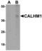 Calcium Homeostasis Modulator 1 antibody, LS-C108656, Lifespan Biosciences, Western Blot image 
