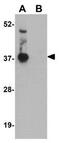 GID Complex Subunit 8 Homolog antibody, GTX31384, GeneTex, Western Blot image 