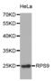40S ribosomal protein S9 antibody, abx002322, Abbexa, Western Blot image 