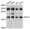 Ribosomal Protein S15 antibody, STJ27734, St John